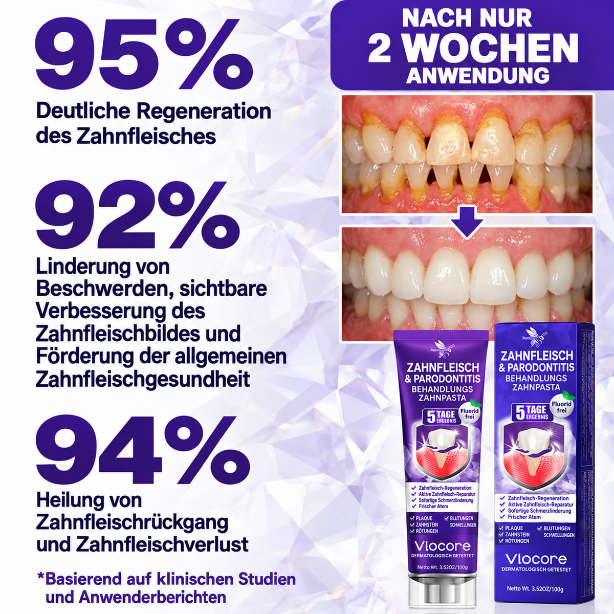 🇦🇹 𝖮𝖿𝖿𝗂𝗓𝗂𝖾𝗅𝗅𝖾𝗋 𝖲𝗁𝗈𝗉 |🍕🍕𝗥𝗼𝗹𝗶𝗺𝗲𝐲® 𝖵𝗂𝗈𝖢𝗈𝗋𝖾 𝖹𝖺𝗁𝗇𝗉𝖺𝗌𝗍𝖺 𝗓𝗎𝗋 𝖡𝖾𝗁𝖺𝗇𝖽𝗅𝗎𝗇𝗀 𝗏𝗈𝗇 𝖹𝖺𝗁𝗇𝖿𝗅𝖾𝗂𝗌𝖼𝗁𝖾𝗇𝗍𝗓ü𝗇𝖽𝗎𝗇𝗀𝖾𝗇 𝗎𝗇𝖽 𝖯𝖺𝗋𝗈𝖽𝗈𝗇𝗍𝗂𝗍𝗂𝗌 𝗆𝗂𝗍 𝖡𝗂𝖾𝗇𝖾𝗇𝗀𝗂𝖿𝗍