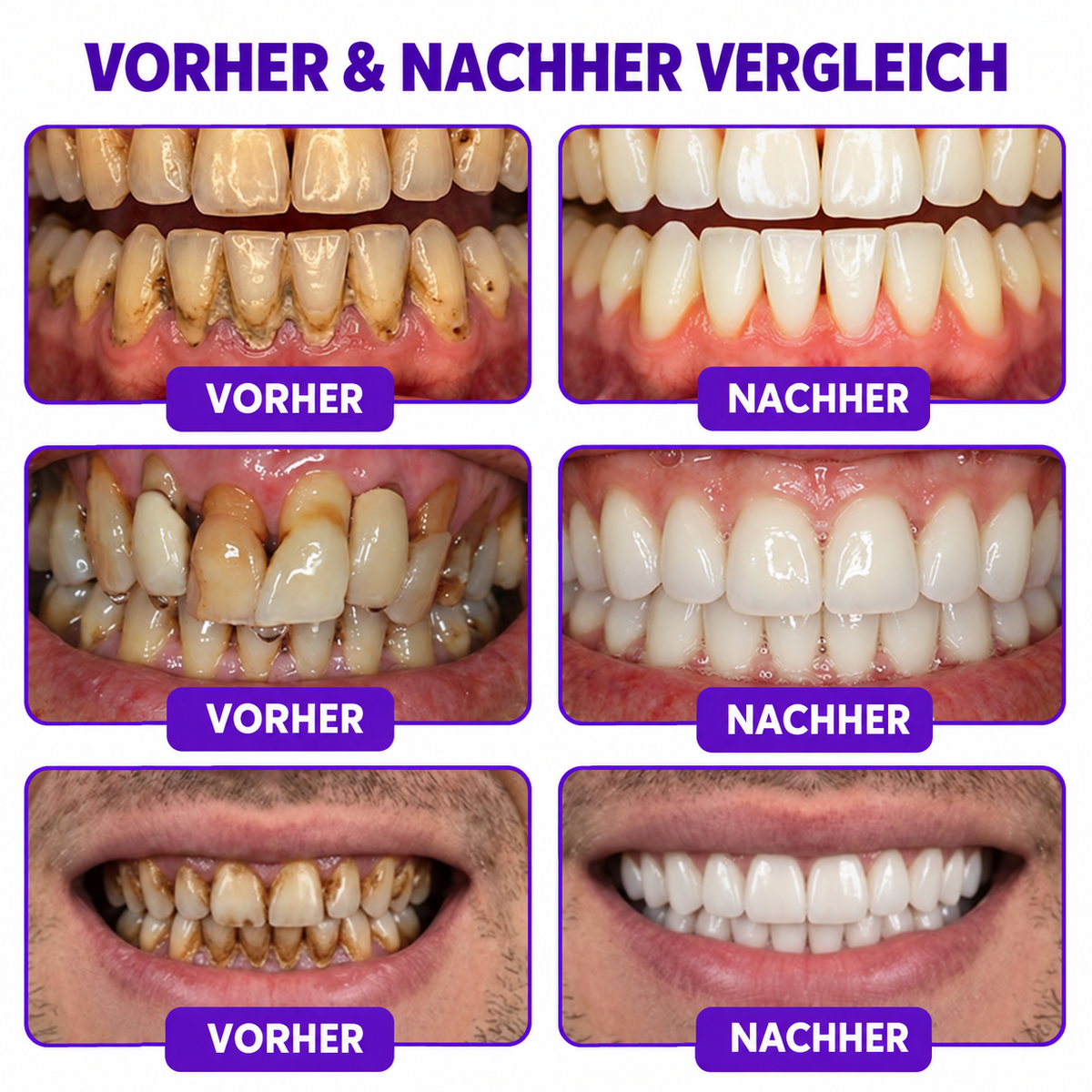 🇦🇹 𝖮𝖿𝖿𝗂𝗓𝗂𝖾𝗅𝗅𝖾𝗋 𝖲𝗁𝗈𝗉 |🍕🍕𝗥𝗼𝗹𝗶𝗺𝗲𝐲® 𝖵𝗂𝗈𝖢𝗈𝗋𝖾 𝖹𝖺𝗁𝗇𝗉𝖺𝗌𝗍𝖺 𝗓𝗎𝗋 𝖡𝖾𝗁𝖺𝗇𝖽𝗅𝗎𝗇𝗀 𝗏𝗈𝗇 𝖹𝖺𝗁𝗇𝖿𝗅𝖾𝗂𝗌𝖼𝗁𝖾𝗇𝗍𝗓ü𝗇𝖽𝗎𝗇𝗀𝖾𝗇 𝗎𝗇𝖽 𝖯𝖺𝗋𝗈𝖽𝗈𝗇𝗍𝗂𝗍𝗂𝗌 𝗆𝗂𝗍 𝖡𝗂𝖾𝗇𝖾𝗇𝗀𝗂𝖿𝗍