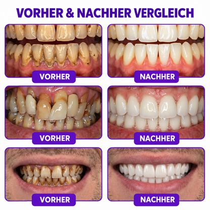 🇦🇹 𝖮𝖿𝖿𝗂𝗓𝗂𝖾𝗅𝗅𝖾𝗋 𝖲𝗁𝗈𝗉 |🍕🍕𝗥𝗼𝗹𝗶𝗺𝗲𝐲® 𝖵𝗂𝗈𝖢𝗈𝗋𝖾 𝖹𝖺𝗁𝗇𝗉𝖺𝗌𝗍𝖺 𝗓𝗎𝗋 𝖡𝖾𝗁𝖺𝗇𝖽𝗅𝗎𝗇𝗀 𝗏𝗈𝗇 𝖹𝖺𝗁𝗇𝖿𝗅𝖾𝗂𝗌𝖼𝗁𝖾𝗇𝗍𝗓ü𝗇𝖽𝗎𝗇𝗀𝖾𝗇 𝗎𝗇𝖽 𝖯𝖺𝗋𝗈𝖽𝗈𝗇𝗍𝗂𝗍𝗂𝗌 𝗆𝗂𝗍 𝖡𝗂𝖾𝗇𝖾𝗇𝗀𝗂𝖿𝗍